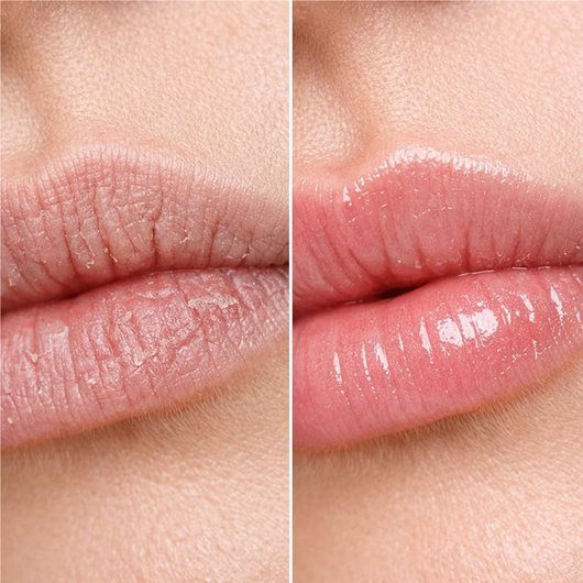 Ayleno Kühlende Peel-Off Lippenmaske