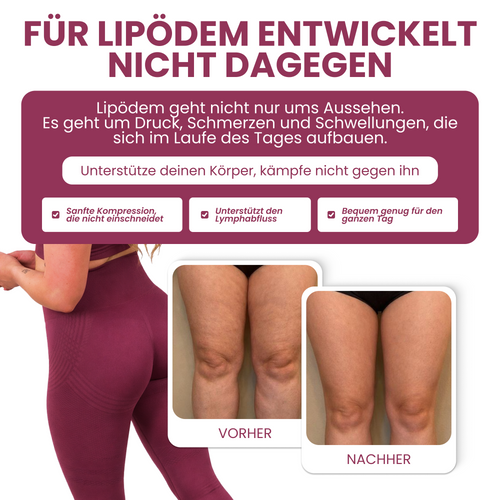 Ayleno 3D Kompressionsleggings mit abgestufter Kompression Cellulite