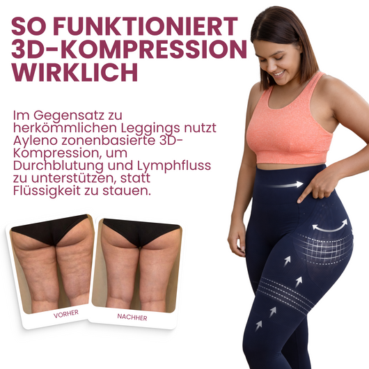 Ayleno 3D Kompressionsleggings mit abgestufter Kompression Cellulite